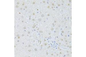 Immunohistochemistry of paraffin-embedded rat liver using SIRT1 antibody (ABIN6291361) at dilution of 1:100 (40x lens).