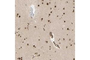 Immunohistochemical staining of human lateral ventricle with ZMYM6 polyclonal antibody  shows strong nuclear positivity in neuronal cells at 1:50-1:200 dilution. (ZMYM6 Antikörper)
