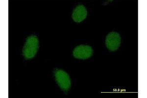 Immunofluorescence of purified MaxPab antibody to C9orf152 on HeLa cell. (C9orf152 Antikörper  (AA 1-218))