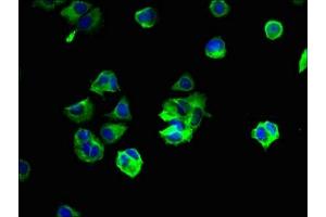 Immunofluorescent analysis of MCF-7 cells using ABIN7166350 at dilution of 1:100 and Alexa Fluor 488-congugated AffiniPure Goat Anti-Rabbit IgG(H+L) (YIPF6 Antikörper  (AA 2-84))