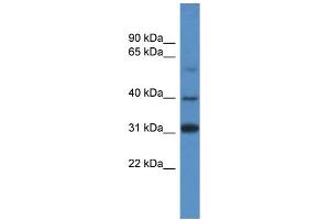 WB Suggested Anti-SOX1 Antibody Titration: 1. (SOX1 Antikörper  (C-Term))