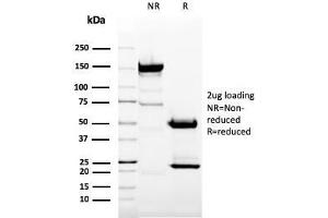 SDS-PAGE Analysis Purified CD11b Mouse Monoclonal Antibody (ITGAM/3337). (CD11b Antikörper  (AA 941-1074))