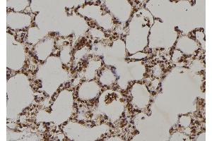ABIN6263216 and ABIN6269229 at 1/100 staining Rat lung tissue by IHC-P. (MEK2 Antikörper  (C-Term))