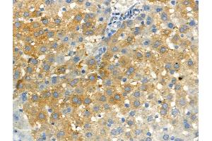 Phospho-RON (Ser1394) Antibody at 1/100 staining Rat liver tissue by IHC-P. (MST1R Antikörper  (pSer1394))