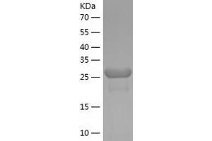 beta Actin Protein (AA 102-375) (His tag)