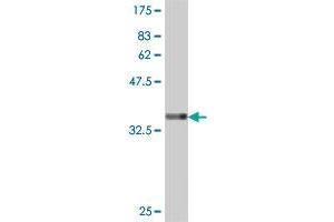 Western Blotting (WB) image for anti-Eukaryotic Translation Initiation Factor 4E Family Member 2 (EIF4E2) (AA 146-245) antibody (ABIN564091)