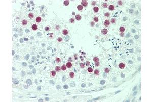 Anti-SYCE2 antibody IHC staining of human testis.