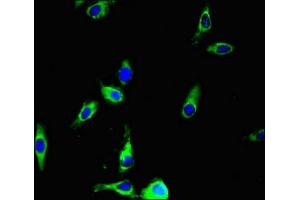 Immunofluorescent analysis of Hela cells using ABIN7144308 at dilution of 1:100 and Alexa Fluor 488-congugated AffiniPure Goat Anti-Rabbit IgG(H+L) (Anoctamin 4 Antikörper  (AA 1-200))