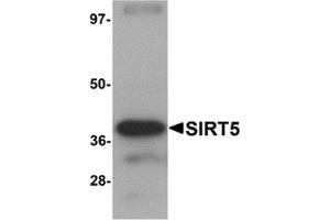 Western blot analysis of SIRT5 in human liver tissue lysate with SIRT5 antibody at 1 μg/ml. (SIRT5 Antikörper  (C-Term))