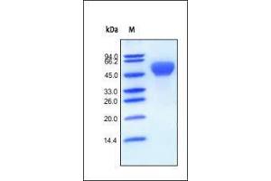 SDS-PAGE (SDS) image for Bone Morphogenetic Protein Receptor 1A (BMPR1A) (AA 24-152) protein (Fc Tag) (ABIN2180583) (BMPR1A Protein (AA 24-152) (Fc Tag))