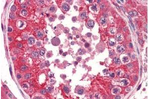 anti-EPH Receptor A2 (EPHA2) (AA 559-976) antibody