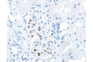 Immunohistochemistry (IHC) image for anti-Tight Junction Protein 1 (TJP1) (AA 650-700) antibody (ABIN7453989)