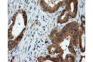 Immunohistochemical staining of paraffin-embedded Kidney tissue using anti-LIPG mouse monoclonal antibody. (LIPG Antikörper)