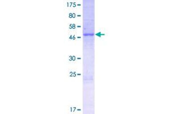 PPP1R42 Protein (AA 1-228) (GST tag)