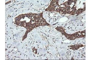 Image no. 1 for anti-Dynamin 1-Like (DNM1L) antibody (ABIN1497870) (Dynamin 1-Like Antikörper)