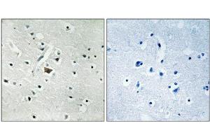 Immunohistochemical analysis of paraffin-embedded human brain tissue using PLD2 (Phospho-Tyr169) antibody (left)or the same antibody preincubated with blocking peptide (right). (Phospholipase D2 Antikörper  (pTyr169))