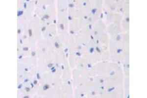 Used in DAB staining on fromalin fixed paraffin- embedded heart tissue (ANKRD1 Antikörper  (AA 1-319))