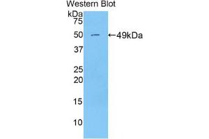 Western blot analysis of the recombinant protein. (Peroxiredoxin 3 Antikörper  (AA 64-257))