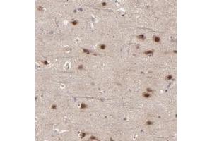 Immunohistochemical staining of human cerebral cortex with BAIAP2L2 polyclonal antibody  shows strong nuclear and cytoplasmic positivity in neuronal cells at 1:50-1:200 dilution. (BAIAP2L2 Antikörper)