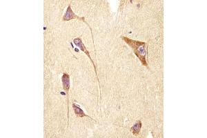 (ABIN6244245 and ABIN6578502) staining GNG2 in human brain tissue sections by Immunohistochemistry (IHC-P - paraformaldehyde-fixed, paraffin-embedded sections).
