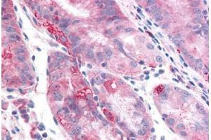 Human Stomach: Formalin-Fixed, Paraffin-Embedded (FFPE) (TMEM33 Antikörper  (Internal Region))
