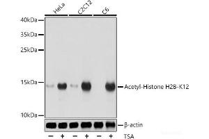Western blot analysis of extracts of various cell lines using Acetyl-Histone H2B-K12 Polyclonal Antibody at dilution of 1:1000.