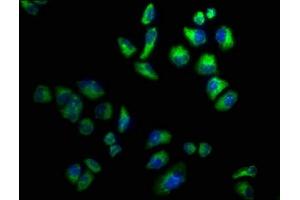 Immunofluorescence staining of Hela cells with ABIN7142963 at 1:100, counter-stained with DAPI. (CHRND Antikörper  (AA 334-471))