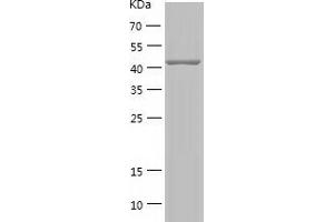 BAF53A Protein (AA 2-429) (His tag)