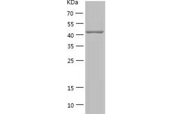 BAF53A Protein (AA 2-429) (His tag)