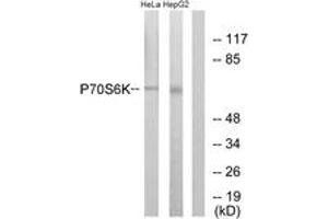 Western blot analysis of extracts from HeLa/HepG2, using p70 S6 Kinase (Ab-371) Antibody. (RPS6KB1 Antikörper  (AA 337-386))