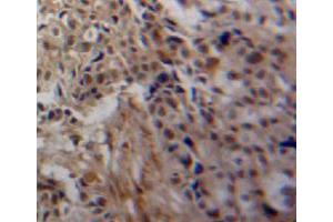 Used in DAB staining on fromalin fixed paraffin-embedded ovary tissue (TGM3 Antikörper  (AA 468-693))