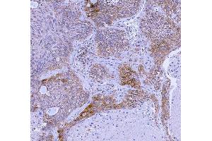 IHC analysis of WDR44 using anti-WDR44 antibody (ABIN7600394). (WDR44 Antikörper  (AA 188-913))