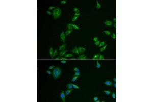 Immunofluorescence analysis of U2OS cells using MLANA Polyclonal Antibody (MLANA Antikörper)