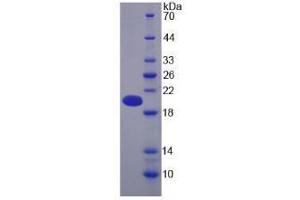 SDS-PAGE analysis of Human Pregnancy Zone Protein. (PZP Protein)