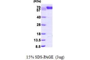 Protein Disulfide Isomerase Family A, Member 4 (PDIA4) (AA 21-645) protein (His tag)