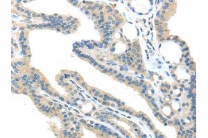 Immunohistochemistry (IHC) image for anti-Vacuolar Protein Sorting 36 (VPS36) antibody (ABIN5959966)