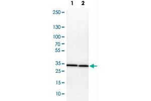 Western Blot analysis of Lane 1: NIH-3T3 cell lysate (mouse embryonic fibroblast cells) and Lane 2: NBT-II cell lysate (Wistar rat bladder tumor cells) with ARPC2 polyclonal antibody . (ARPC2 Antikörper)