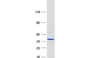 Validation with Western Blot (SDR16C5 Protein (Myc-DYKDDDDK Tag))