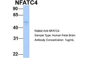 Western Blotting (WB) image for anti-Nuclear Factor of Activated T-Cells, Cytoplasmic, Calcineurin-Dependent 4 (NFATC4) (N-Term) antibody (ABIN2780606)