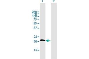 Western Blot analysis of GPX7 expression in transfected 293T cell line by GPX7 MaxPab polyclonal antibody. (Glutathione Peroxidase 7 Antikörper  (AA 1-187))