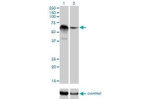Western blot analysis of RBM5 over-expressed 293 cell line, cotransfected with RBM5 Validated Chimera RNAi (Lane 2) or non-transfected control (Lane 1). (RBM5 Antikörper  (AA 75-184))