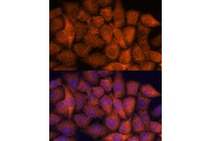 Immunofluorescence analysis of HeLa cells using RP antibody (ABIN7270101) at dilution of 1:100. (RPAP3 Antikörper  (AA 17-241))