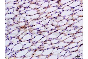 Formalin-fixed and paraffin embedded rat kidney tissue labeled with Anti-STAT2 Polyclonal Antibody, Unconjugated (ABIN738246) at 1:200 followed by conjugation to the secondary antibody, (SP-0023), and DAB staining (STAT2 Antikörper  (AA 151-250))