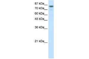 WB Suggested Anti-SMARCA3 Antibody Titration:  2. (HLTF Antikörper  (N-Term))