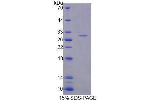 Image no. 1 for Proteasome Subunit alpha 5 (PSMA5) (AA 1-241) protein (His tag) (ABIN6237482) (PSMA5 Protein (AA 1-241) (His tag))