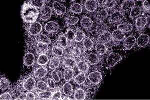 Immunofluorescence staining of A431 cells (Human epithelial carcinoma, ATCC CRL-1555). (NUP88 Antikörper  (AA 314-425))