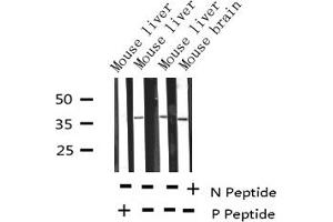 Western blot analysis of Phospho-RFA2 (Thr21) expression in various lysates