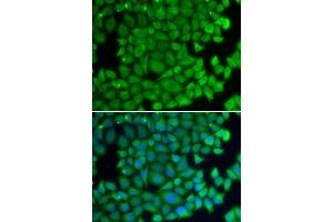 Immunofluorescence analysis of U2OS cells using HSPB2 antibody (ABIN6131082, ABIN6142054, ABIN6142055 and ABIN6219505).