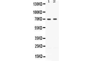 Western blot analysis of ZAP70 expression in JURKAT whole cell lysates ( Lane 1) and CEM whole cell lysates ( Lane 2).