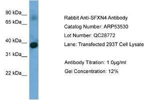 WB Suggested Anti-SFXN4  Antibody Titration: 0. (Sideroflexin 4 Antikörper  (N-Term))